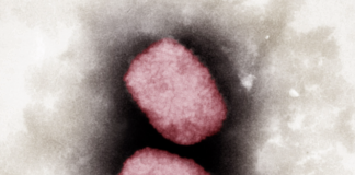 Monkey pox: how is it transmitted, what are the symptoms?