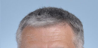 National Assembly: Laurent Croizier, elected Together! believer in transparency